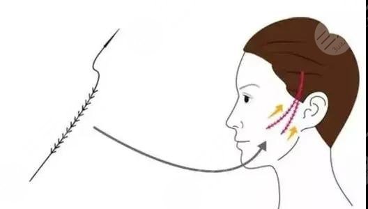 提升抗皱的副作用和危害