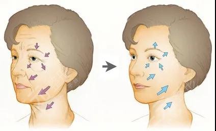 提升抗皱的副作用和危害