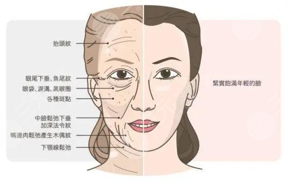 医美5d胶原光副作用
