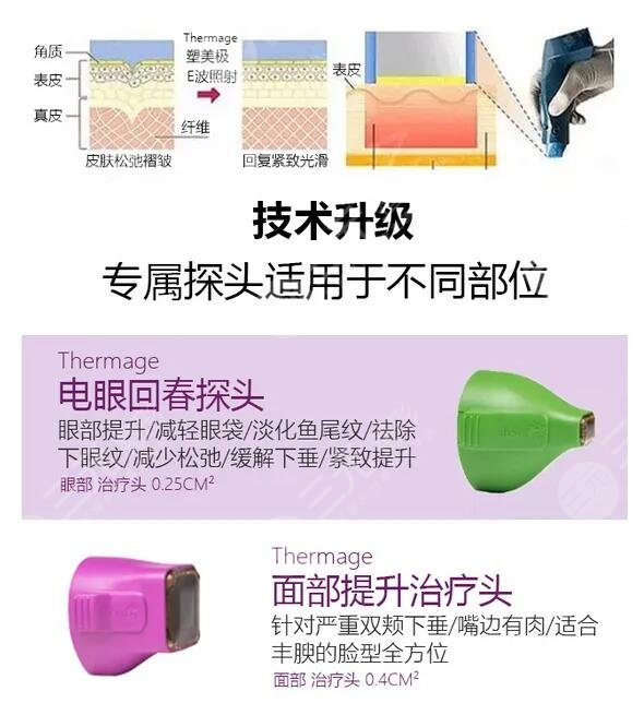 做热玛吉的好处