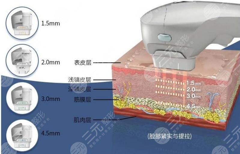 做热玛吉的坏处