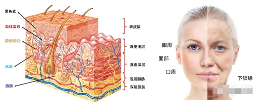 赛诺秀5d胶原光多少钱