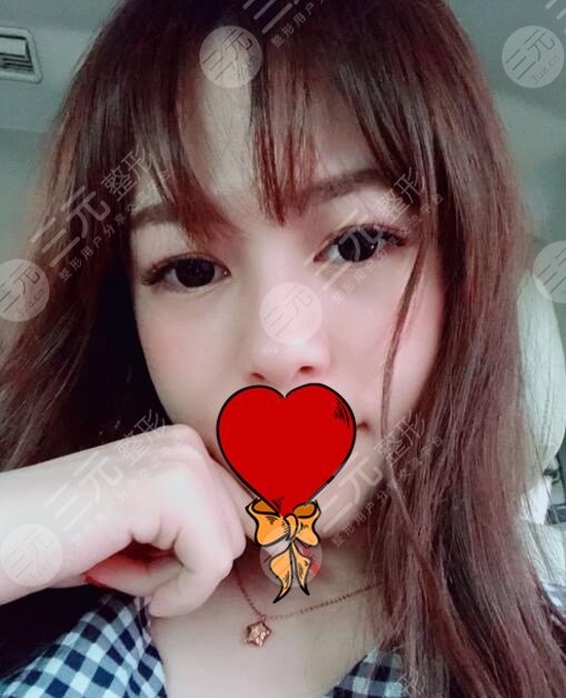 欧洲之星术后