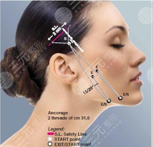 提升抗皱的副作用有哪些?