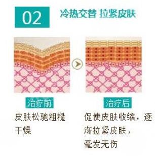 欧洲之星作用