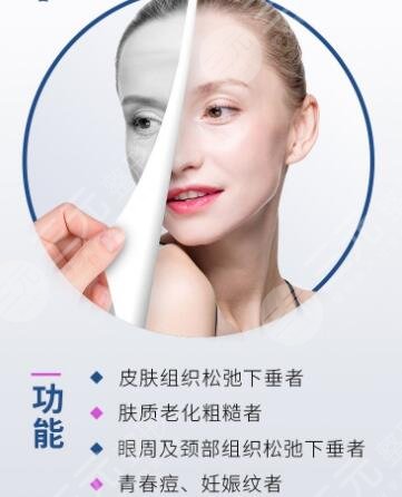 欧洲之星能够GET怎样的果