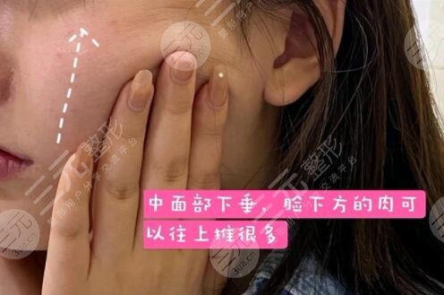 热玛吉前