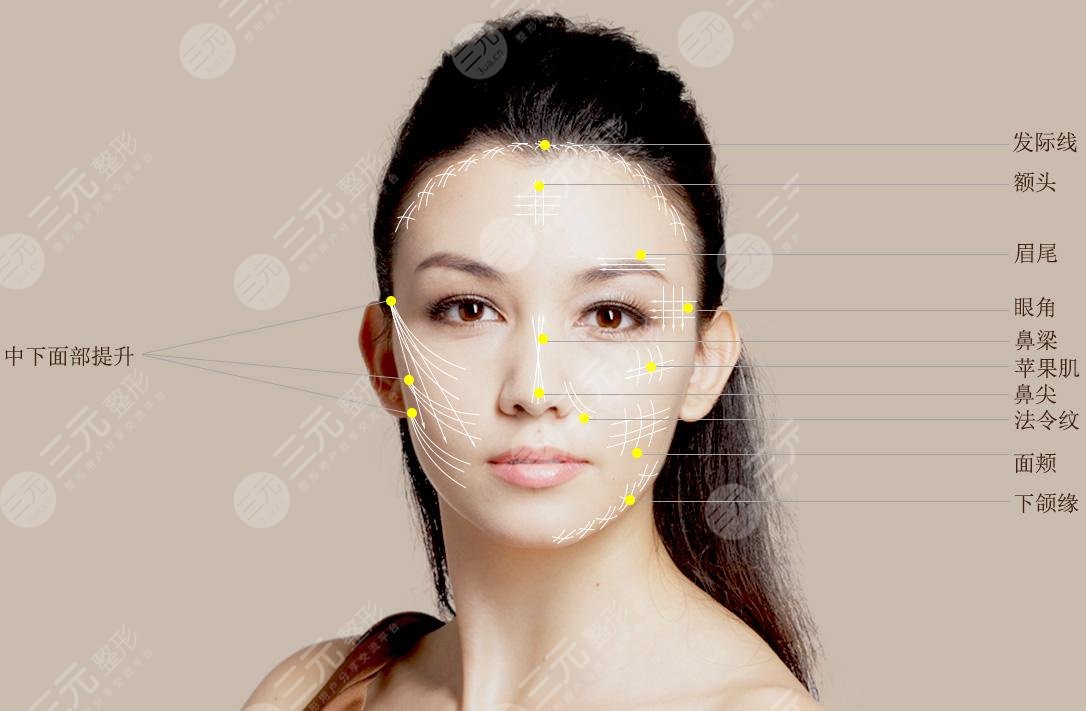 提升抗皱后多久可以做热玛吉