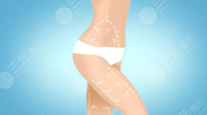 国内抽脂手术成熟吗