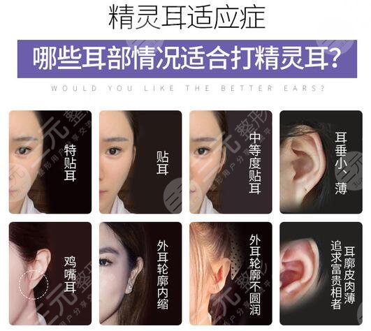 颅耳角在30°-60°之间整形方法