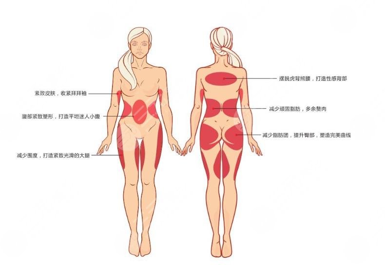 欧洲之星4D能不能只做局部?