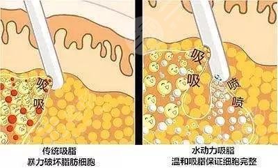 钻石和水动力哪个好