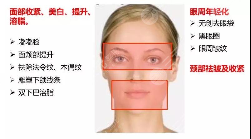 欧洲之星4d和热玛吉区别