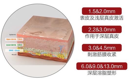 7d聚拉提做脸优点在哪里