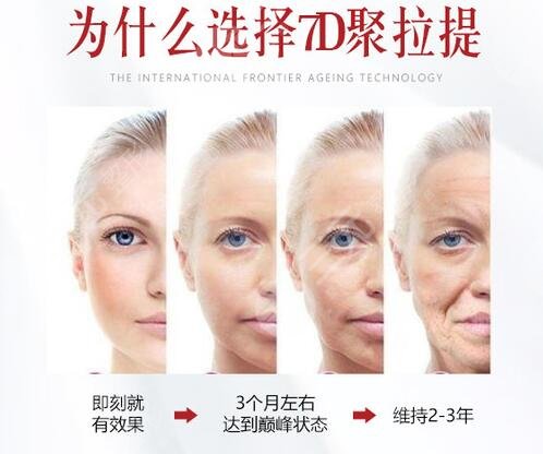 聚拉提价格