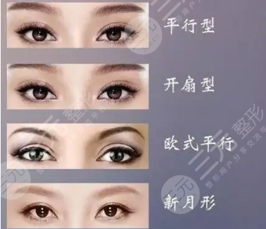 4种双眼皮类型图片揭晓，第2种是公认的气质型！