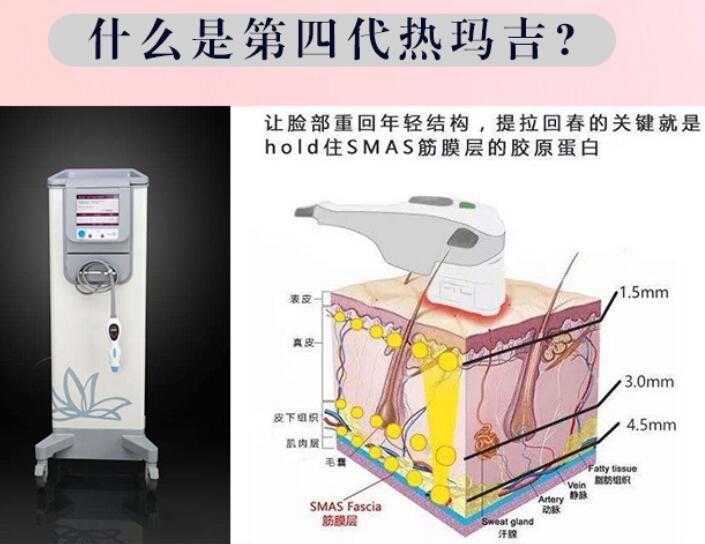 5d胶原光PK热玛吉