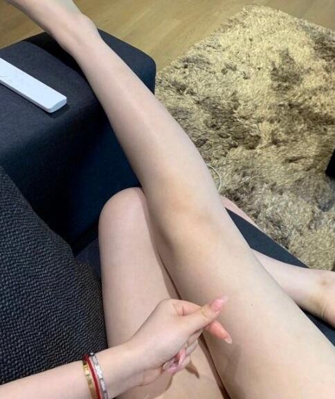 国内吸脂医院:北京禾美嘉大腿吸脂案例