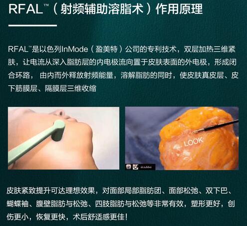 钻石吸脂瘦脸怎么样