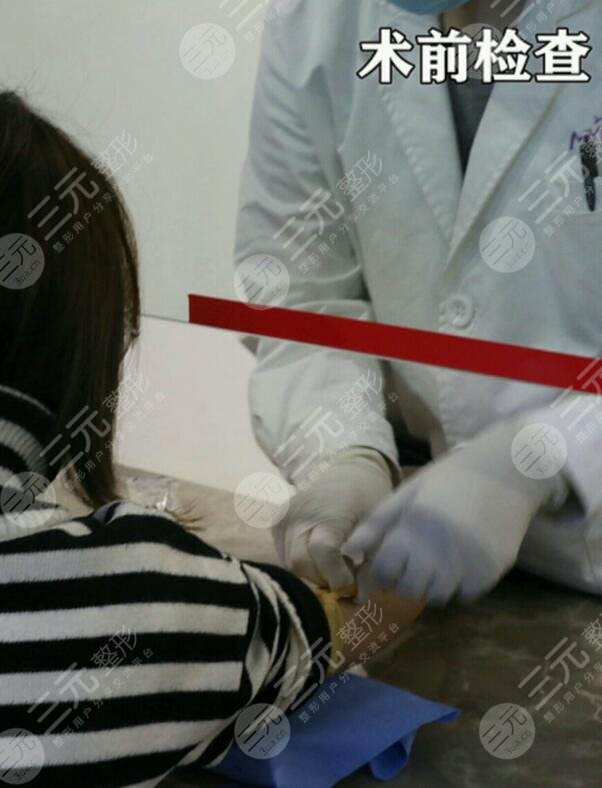 做眼部手术的注意事项