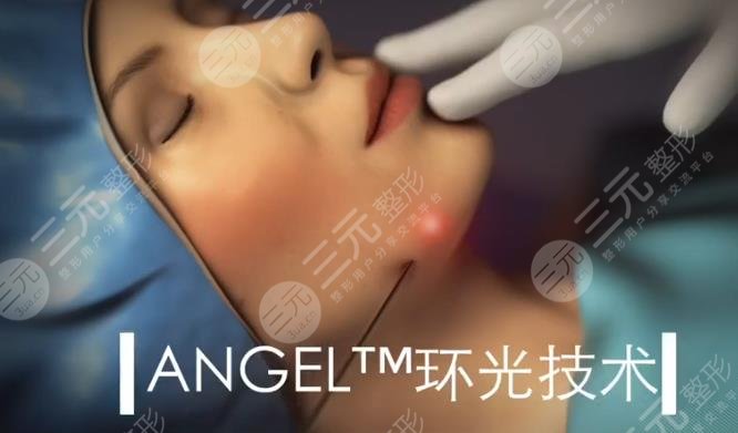 5g天使光雕一个部位多少钱