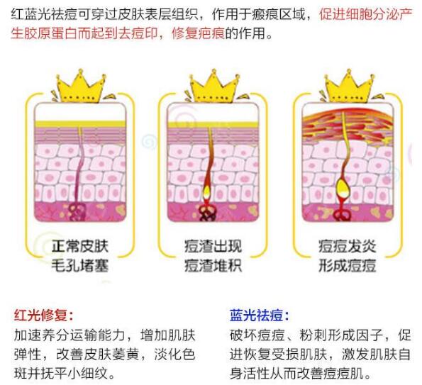 上海佰思爱医疗美容科普激光祛痘
