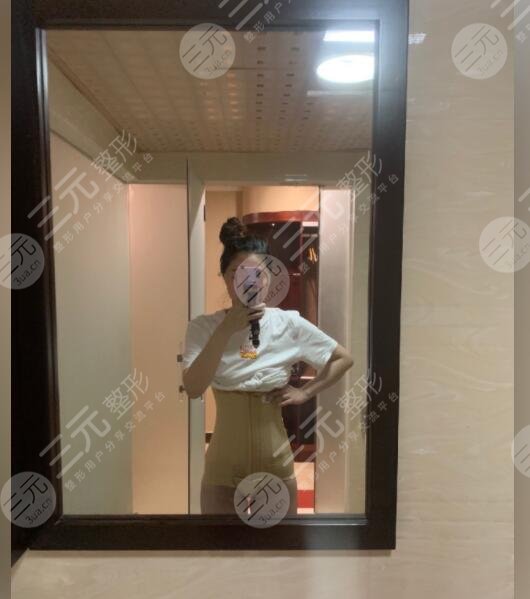 吸脂手术过程