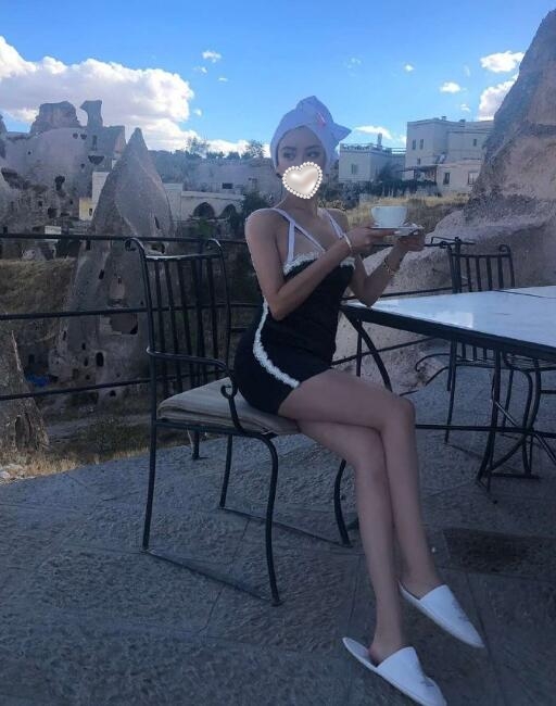 钻石吸脂恢复果图