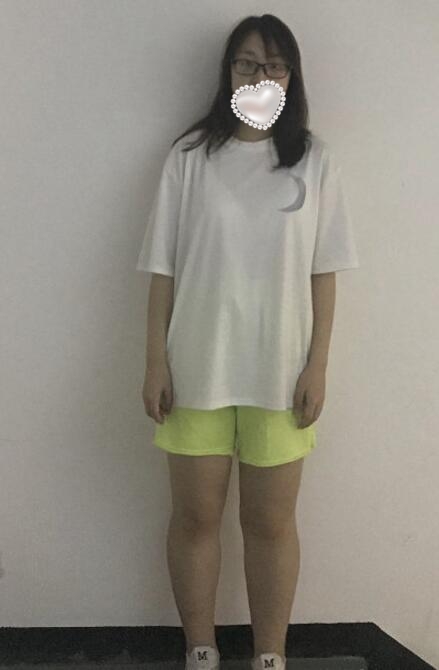 水动力吸脂果图