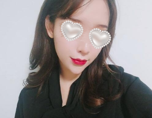 吸脂去双下巴果图