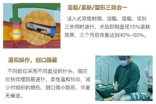 钻石成好吗