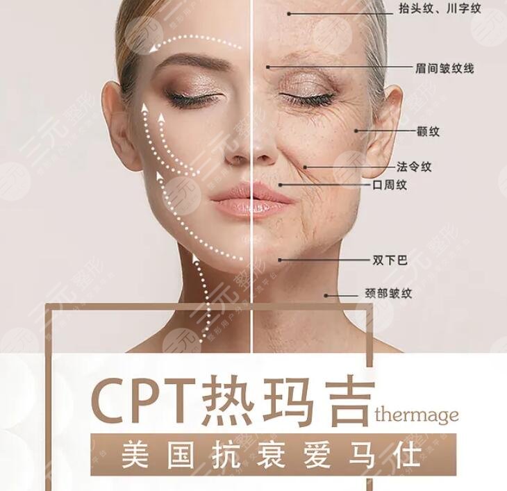 热玛吉抗衰果好