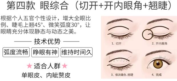 徐州医科汇美美容医院科普眼部综合整形