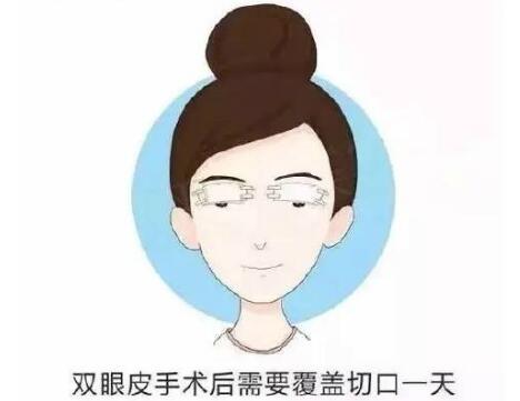 徐州医科汇美美容医院科普眼部综合整形