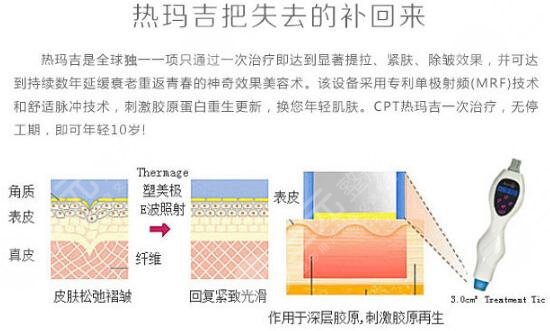 杭州智美颜和医疗美容科普热玛吉