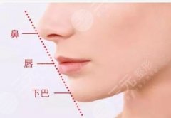 自体脂肪垫下巴价格表2021曝光！一般多少钱？来看你的钱包够不！