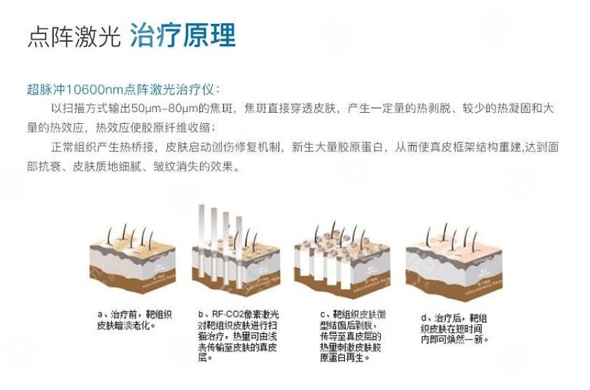 上海九院疤痕相关问题