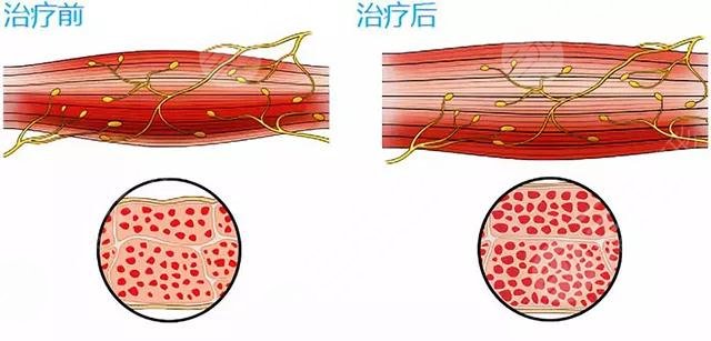 美修斯
