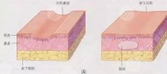 玻尿酸填充面颊多少钱?2021注射美容价格表供你参考! 玻尿酸填充面颊多少钱?2021注射美容价格表供你参考!