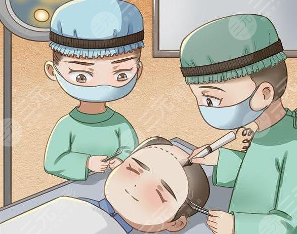 发际线种植相关介绍科普