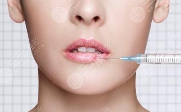非手术丰唇方法有哪些？优缺点科普，解锁撩人美唇的秘籍！