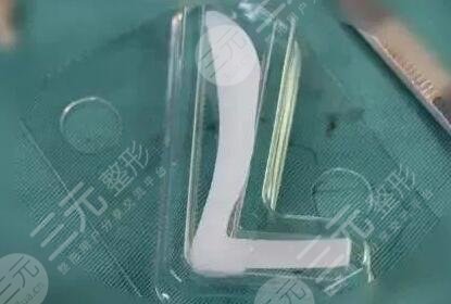 上海鼻子专家赵延峰技术口碑如何医生详情鼻整形果俏皮又艳丽