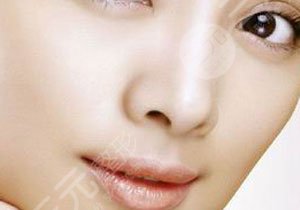 广州鼻王沈绍勇医生手术缩鼻头科普：副作用、