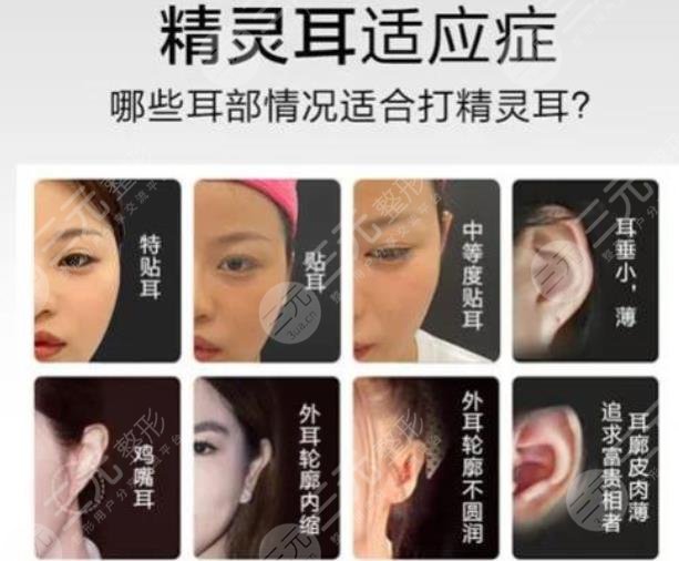 颅耳角在30°-60°之间整形多少钱