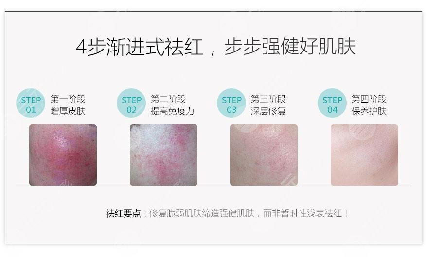 红血丝去除