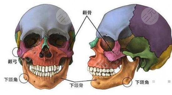 颧骨整形价格