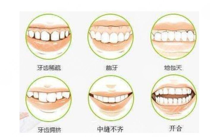 牙科私人贵还是医院贵