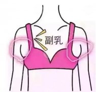 副乳吸脂好还是切除好，成好吗？恢复图片&价格表指南分享！