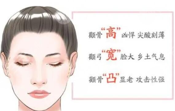 什么人适合做颧骨磨骨