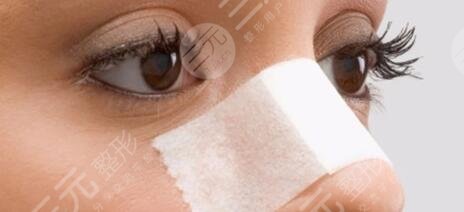 做假体隆鼻术后怎么护理